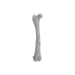 Femur - Canine - Fracture II 32-B1 acc. to AOVet