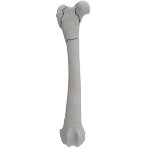 Femur - Canine - Fracture II 31-B3 acc. to AOVet