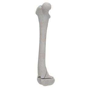 Femur - Canine - Fracture 33-A3 acc. to AOVet