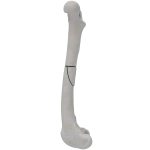 Femur - Canine - Fracture III 32-B1 acc. to AOVet