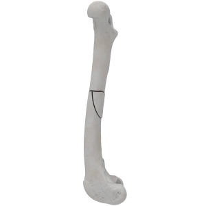 Femur - Canine - Fracture III 32-B1 acc. to AOVet