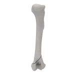 Humerus - Canine - Fracture 13-A1 acc. to AOVet