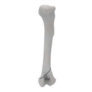 Humerus - Canine - Fracture 13-A1 acc. to AOVet