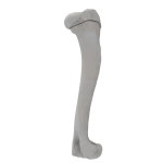 Humerus - Canine - Fracture 11-A3 acc. to AOVet