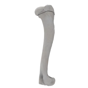 Humerus - Canine - Fracture 11-A3 acc. to AOVet