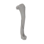 Humerus - Canine - Fracture 12-A2 acc. to AOVet