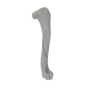 Humerus - Canine - Fracture 12-A2 acc. to AOVet