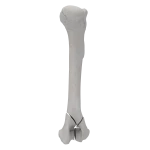 Humerus - Canine - Fracture I 13-C1 acc. to AOVet (Type Y)