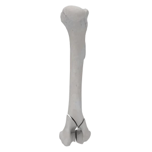 Humerus - Canine - Fracture I 13-C1 acc. to AOVet (Type Y)