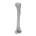 Humerus - Canine - Fracture II 13-C1 acc. to AOVet (Type T)