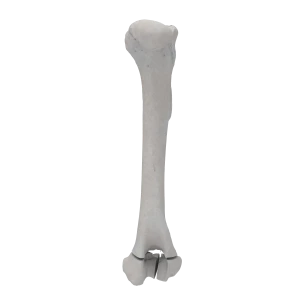 Humerus - Canine - Fracture II 13-C1 acc. to AOVet (Type T)