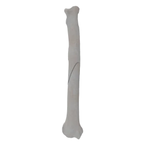 Radius - Canine - Fracture II 22-A1 acc. to AOVet