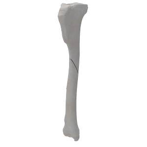 Tibia - Canine - Fracture 42-A2  acc. to AOVet