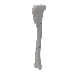 Tibia - Canine - Fracture 42-C2  acc. to AOVet