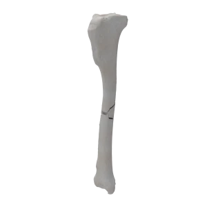Tibia - Canine - Fracture 42-B1 acc. to AOVet
