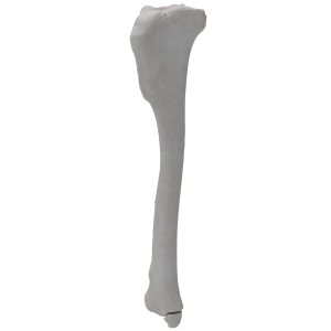 Tibia - Canine - Fracture 43-B2 acc. to AOVet