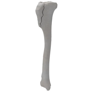 Tibia - Canine - Fracture 41-A1 acc. to AOVet