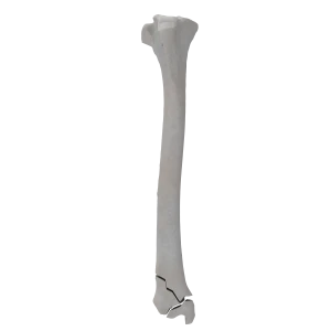 Tibia - Canine - Fracture 43-C2 acc. to AOVet