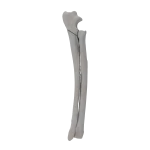 Radius and Ulna - Canine - Fracture 21-A1 acc. to AOVet 