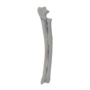 Radius and Ulna - Canine - Fracture 21-A1 acc. to AOVet 