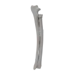 Radius and Ulna - Canine - Fracture 21-A2 acc. to AOVet 