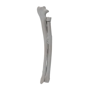 Radius and Ulna - Canine - Fracture 21-A2 acc. to AOVet 