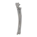 Radius and Ulna - Canine - Fracture 21-A3 acc. to AOVet
