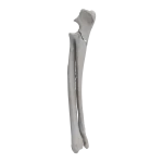Radius and Ulna - Canine - Fracture 21-B1 acc. to AOVet