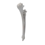 Radius and Ulna - Canine - Fracture 21-B2 acc. to AOVet