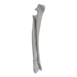 Radius and Ulna - Canine - Fracture 22-A1 acc. to AOVet