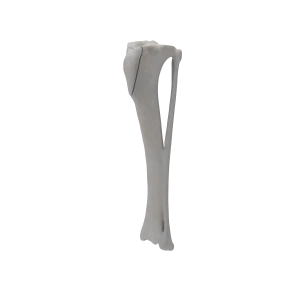 Tibia and Fibula - Canine - Fracture 41-A1 acc. to AOVet