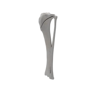 Tibia and Fibula - Canine - Fracture 41-A2 acc. to AOVet