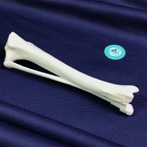 Tibia and Fibula - Canine - Fracture 43-A1 acc. to AOVet
