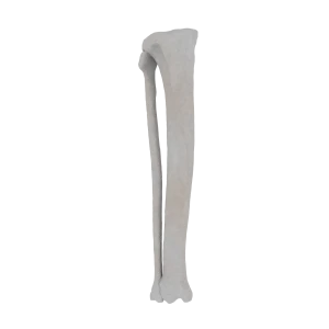 Tibia and Fibula - Feline