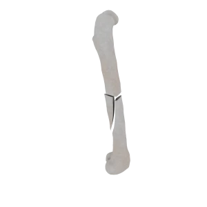 Femur - Feline - Fracture 32-B1 acc. to AOVet