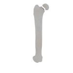 Femur - Feline - Fracture 31-B2 acc. to AOVet