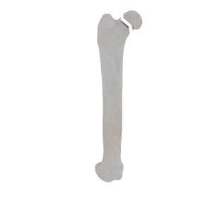 Femur - Feline - Fracture 31-B2 acc. to AOVet
