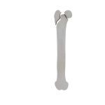 Femur - Feline - Fracture 31-B3 acc. to AOVet 