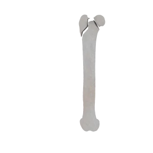Femur - Feline - Fracture 31-B3 acc. to AOVet 
