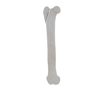 Femur - Feline - Fracture 31-A1 acc. to AOVet