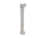 Femur - Feline - Fracture 31-A2 acc. to AOVet