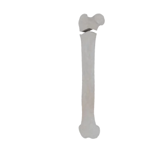 Femur - Feline - Fracture 31-A2 acc. to AOVet