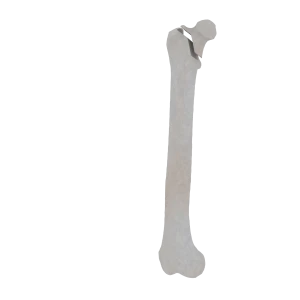 Femur - Feline - Fracture 31-B1 acc. to AOVet