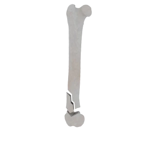 Femur - Feline - Fracture 33-A2 acc. to AOVet