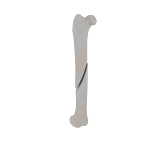 Femur - Feline - Fracture 32-A2 acc. to AOVet