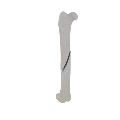 11-a2.474.png