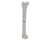 Femur - Feline - Fracture 32-A3 acc. to AOVet