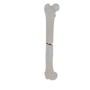 Femur - Feline - Fracture 32-A3 acc. to AOVet