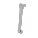 Femur - Feline - Fracture 33-B1 acc. to AOVet