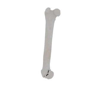 Femur - Feline - Fracture 33-B1 acc. to AOVet